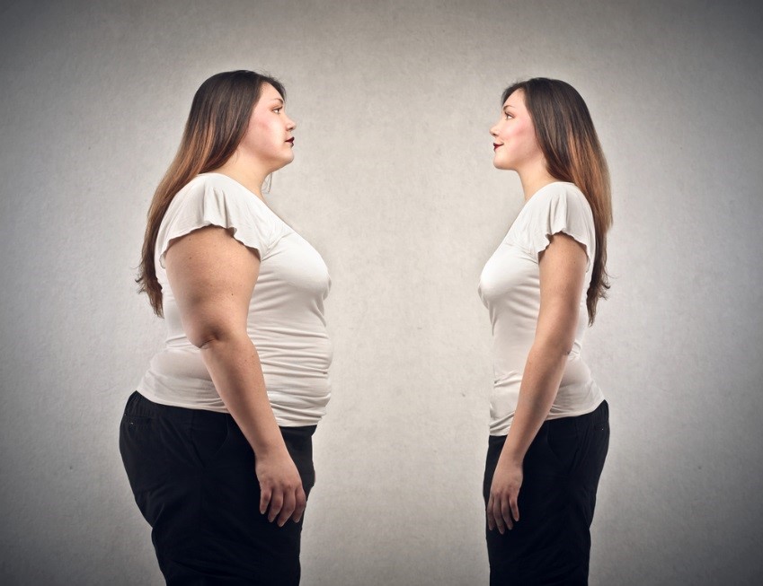 Are You Overweight? You May Reconsider Plastic Surgery