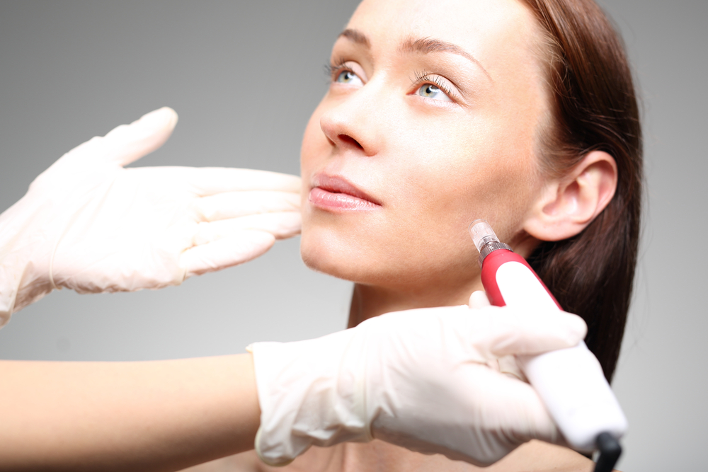 The Basics of PRP and Microneedling