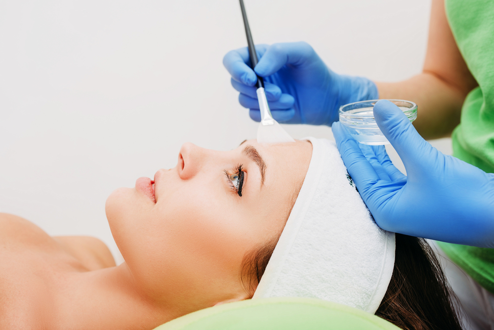 The Benefits of Chemical Peels